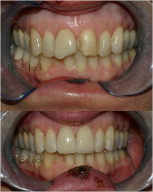 Dr. Bullock - Prosthodontist