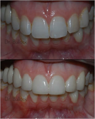 Dr. Bullock - Prosthodontist