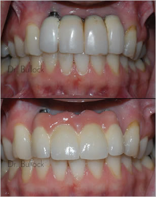 Dr. Bullock - Prosthodontist