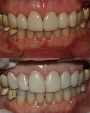 Dr. Bullock - Prosthodontist